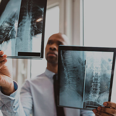 Richmond Catastrophic Injury Lawyer