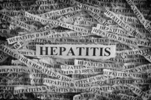 hepatitis