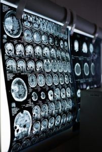 MRI xray images