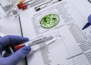 pruebas de listeria en un laboratorio