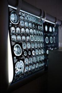 A wall of brain scans