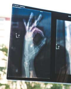 X-ray of a hand making an OK sign