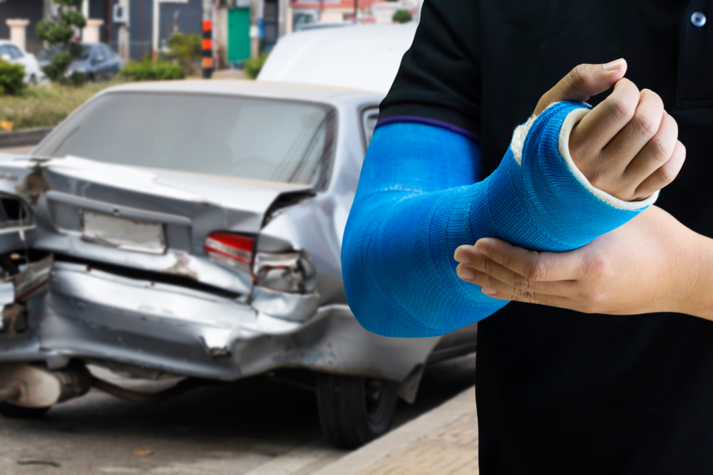 Imagen estilizada de una persona con el brazo enyesado, superpuesta sobre la escena de un accidente automovilístico.
